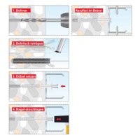 Tox Metallständer-Befestigung MSB 6/35